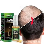 5-pcs-Ginger-Hair-Growth-Product-Anti-loss-Hair-Regrowth-Serum-Oil-Fast-Grow-Prevent-Baldness-2