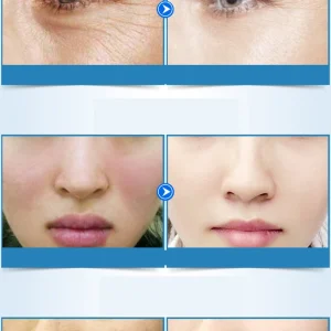Essence-Hyaluronic-Acid-Face-Serum-Moisturizing-Whitening-Shrink-Pores-Firming-Essence-Anti-Aging-Face-Skincare-1
