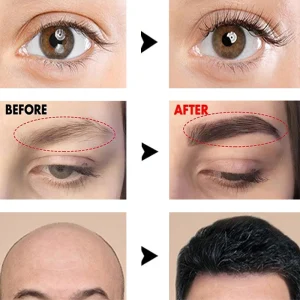 Eyelash-Fast-Grow-Serum-Thicker-Lengthening-Hair-Growth-Anti-Hairs-Loss-Products-Prevent-Baldness-Lengthening-Eyebrow-1