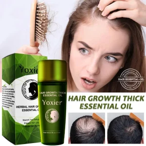 Ginger-Hair-Growth-Products-Prevent-Hair-Loss-Essential-Oil-Fast-Growing-Scalp-Treatment-Beauty-Health-For
