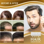 Hair-Growth-Products-Biotin-Anti-Hair-Loss-Spray-Scalp-Treatment-Fast-Growing-Care-Essential-Oils-for-5