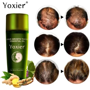 Hair-Growth-Products-Fast-Growing-Hair-Essential-Oil-Natural-Anti-Hair-Loss-Prevent-Hair-Dry-Frizzy-1