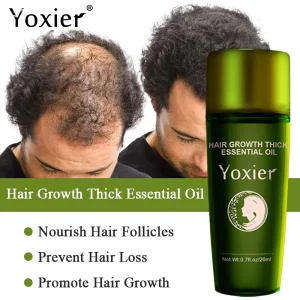 Hair-Growth-Products-Fast-Growing-Hair-Essential-Oil-Natural-Anti-Hair-Loss-Prevent-Hair-Dry-Frizzy