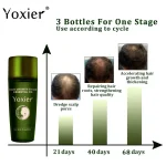 Hair-Growth-Products-Fast-Growing-Hair-Essential-Oil-Natural-Anti-Hair-Loss-Prevent-Hair-Dry-Frizzy-4