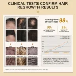 Hair-Growth-Products-For-Men-Women-Collagen-Anti-Hair-Loss-Treatment-Fast-Grow-Hair-Spray-Regrowth-4
