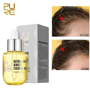 Hair-Growth-Serum-Ginger-Extract-Prevent-Hair-Loss-Oil-Scalp-Treatments-Fast-Growing-Hair-Care-Products-1