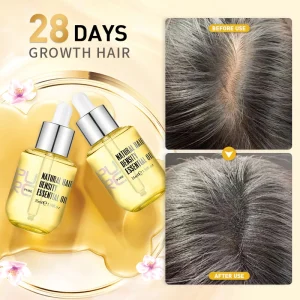 Hair-Growth-Serum-Ginger-Extract-Prevent-Hair-Loss-Oil-Scalp-Treatments-Fast-Growing-Hair-Care-Products
