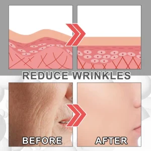 Wrinkle-Remover-Face-Cream-Skin-Care-Korean-Cosmetic-Lifting-Firming-Anti-Aging-Fade-Fine-Lines-Tighten-1