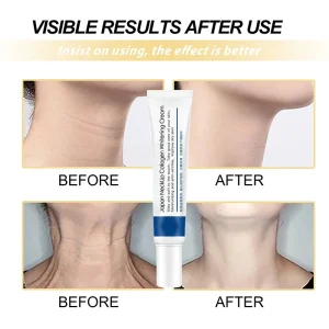 Collagen-Neck-Cream-Anti-aging-Tightens-Lifts-The-Neck-Chin-Efficient-Reducing-Fine-Lines-In-Skincare-1