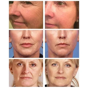 Collagen-Wrinkle-Removal-Cream-Fade-Fine-Lines-Firming-Lifting-Anti-Aging-Improve-Puffiness-Moisturizing-Tighten-Beauty-1