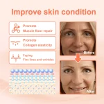 Rose-VC-Anti-Wrinkle-Essence-Oil-Deep-Anti-Aging-Improves-Fine-Lines-Nasolabial-Wrinkles-Head-Lines-4