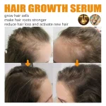2024-New-30ml-Biotin-Fast-Growing-Hair-Care-Essential-Oils-Anti-Hair-Loss-Spray-Scalp-Treatment-10