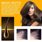 2024-New-30ml-Biotin-Fast-Growing-Hair-Care-Essential-Oils-Anti-Hair-Loss-Spray-Scalp-Treatment-9