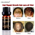 CZLMI-Hair-Loss-Products-Natural-with-No-Side-Effects-Grow-Hair-Faster-Regrowth-Hair-Growth-Products-4