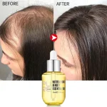 PURC-Fast-Hair-Growth-Serum-Oil-for-Men-Women-Ginger-Anti-Hair-Loss-Scalp-Treatment-Grow-1