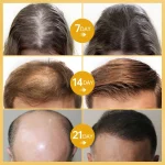 PURC-Fast-Hair-Growth-Serum-Oil-for-Men-Women-Ginger-Anti-Hair-Loss-Scalp-Treatment-Grow-2