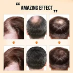 PURC-Fast-Hair-Growth-Serum-Oil-for-Men-Women-Ginger-Anti-Hair-Loss-Scalp-Treatment-Grow-3