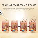 PURC-Fast-Hair-Growth-Serum-Oil-for-Men-Women-Ginger-Anti-Hair-Loss-Scalp-Treatment-Grow-5